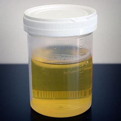 Sample Urine  [Image Source]