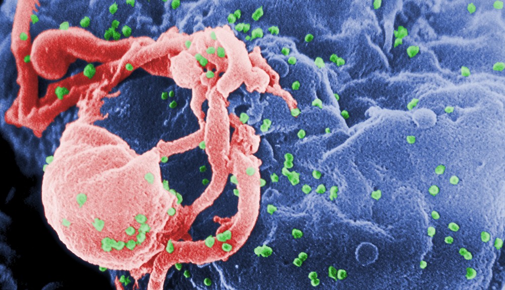 Sel HIV [image source]