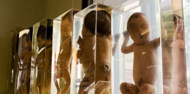 Bayi-bayi dipajang di salah satu sudut Siriraj Medical Museum [Image Source]