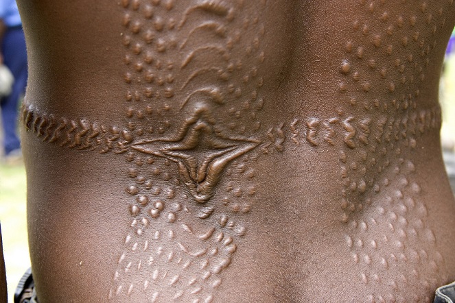 Bekas luka yang menjadi simbol keseksian wanita Ethiopia [Image Source]