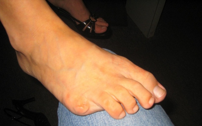 Jari kelingkin kaki [Image Source]