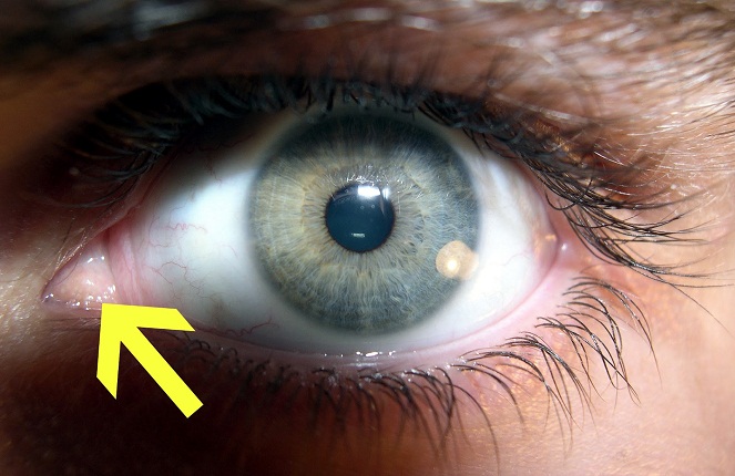 Third eyelid atau lapisan mata ketiga [Image Source]