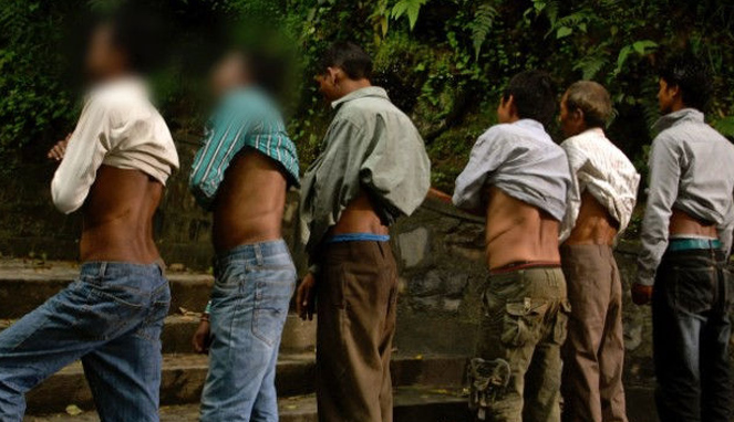 Para pria korban penjualan ginjal [Image Source]