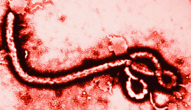 Virus Ebola [Image Source]