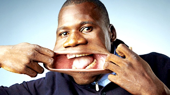 Pria ini bisa memasukkan sebuah kaleng cola ke dalam mulutnya [Image Source]