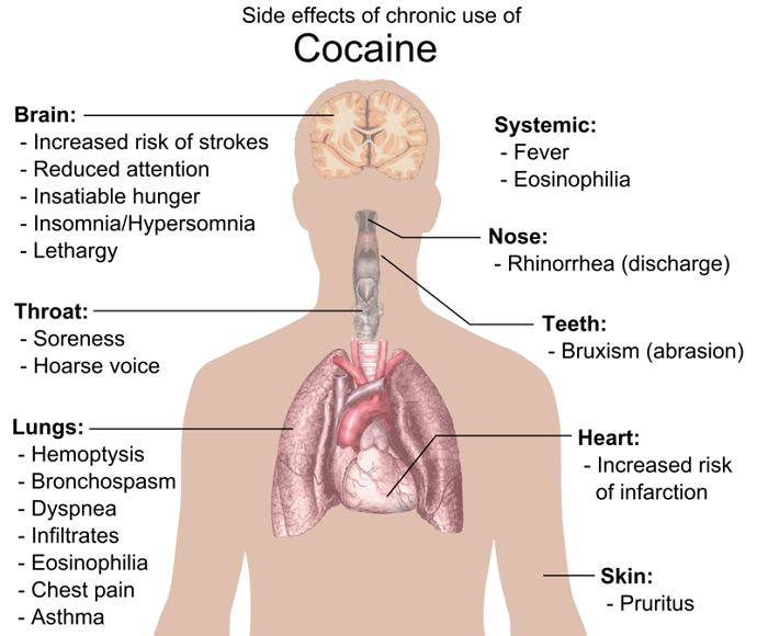 Kokain dapat menghancurkan fungsi organ dalam tubuh