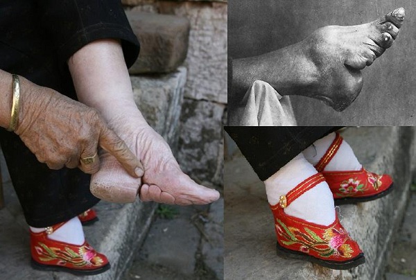 Pada zaman dinasti Qing, pembuatan lotus feet sempat dilarang