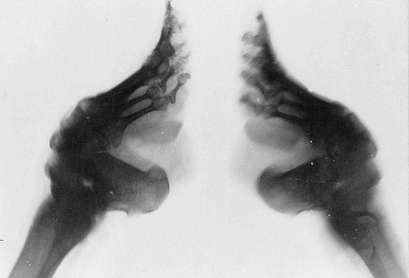 X-ray kaki lotus Feet