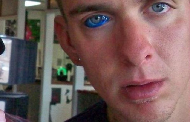 Penasaran rasanya punya mata biru seperti bule? Mungkin trend ini bisa kamu coba [Image Source]