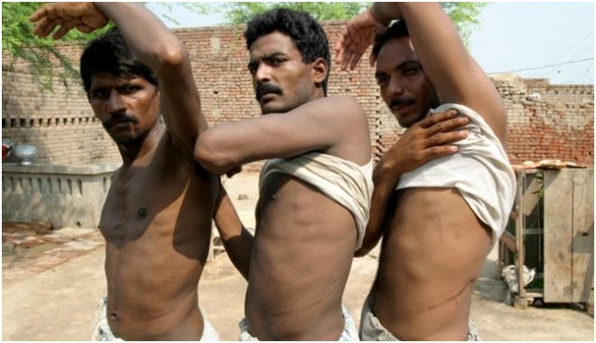 Para pria pakistan menunjukkan bekas sayatan setelah menjual ginjal mereka [Image Source]