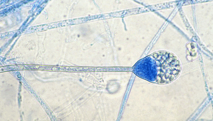Spora Apophysomyces [image source]