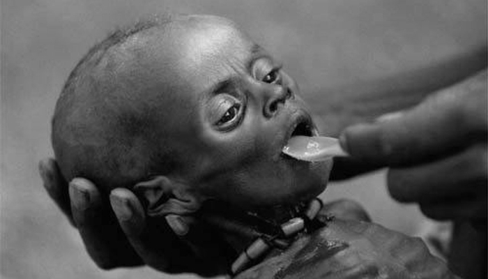 kematian akibat wabah kelaparan [image source]