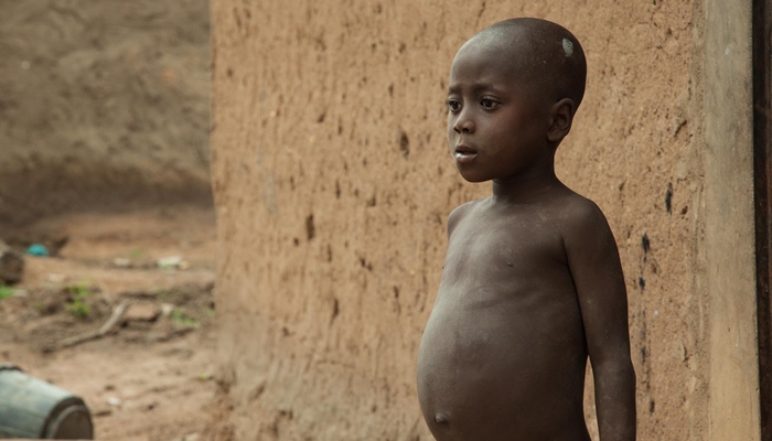 malnutrisi [image source]