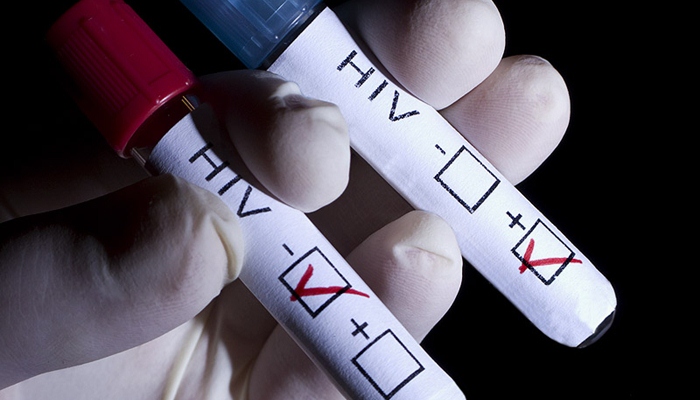 HIV [image source]