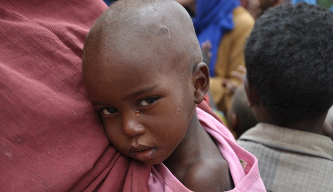 Banyak anak-anak tewas karena lapar [Image Source]