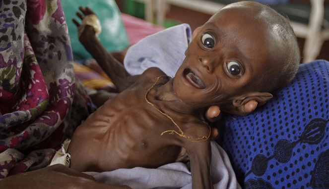 Ada belasan juta bayi kelaparan [Image Source]