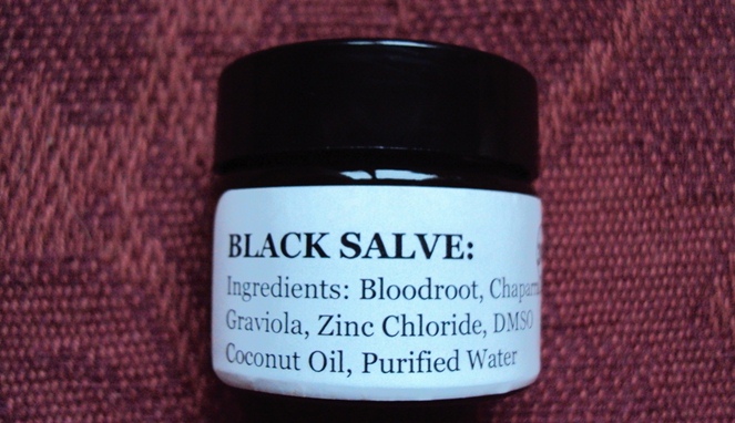 Black Salve [Image Source]