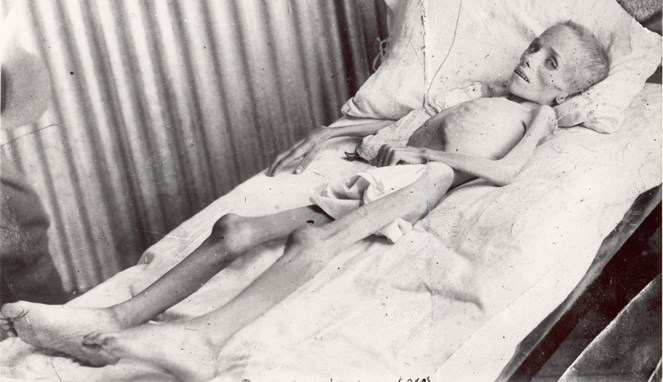 Kondisi anak-anak di kamp konsentrasi Boer [Image Source]