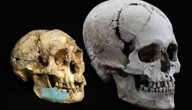 Perbedaan tengkorak Homo Floresiensis dan manusia [Image Source]