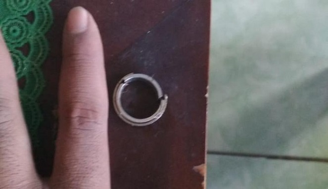 Ilustrasi cincin yang sempat nyangkut di kemaluan seorang pria Cilacap. [Sumber Gambar]
